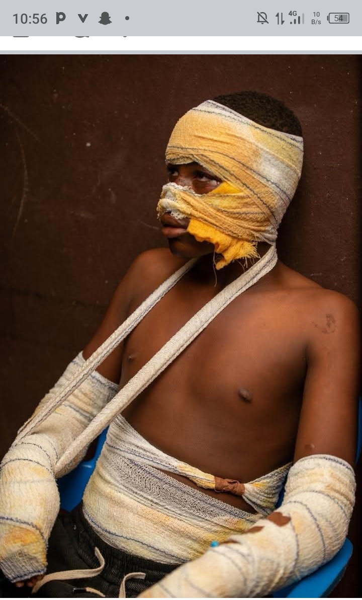 Auchi Fire Disaster: 25 Hurt, 16 in Hospital, Govt Pledges Support